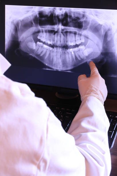 Best Emergency Dentist for Lost Fillings or Crowns in Prairie City, IA